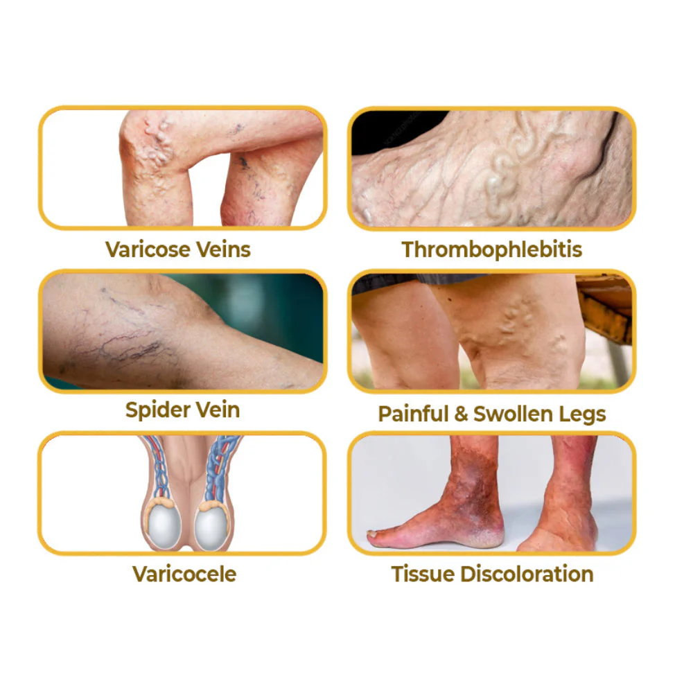 flysmus™ Varico-X Vein Dredge Bee Venom Spray - Image 10