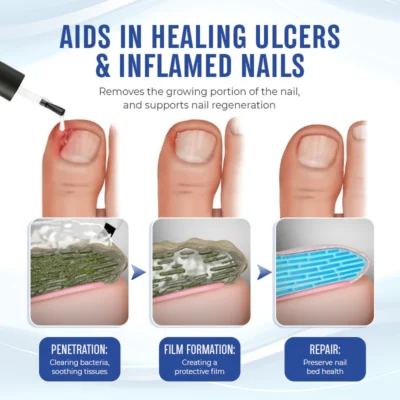Biancat™ FungGone Herbal Paronychia Treatment Gel - Image 5