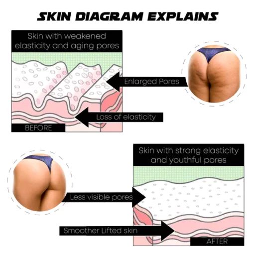 Ricpind EMS HipLift FirmerButtocks Trainer - Image 3