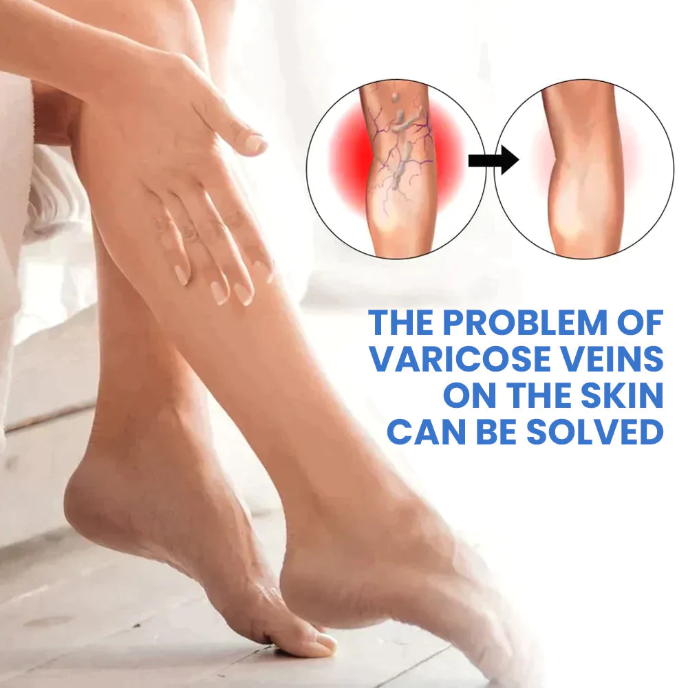 Oveallgo™ VenenErleichtern Varikosener Spray - Image 5