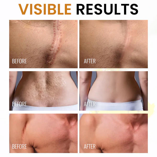 BeevHeal™ Scar Removal Spray - Image 8