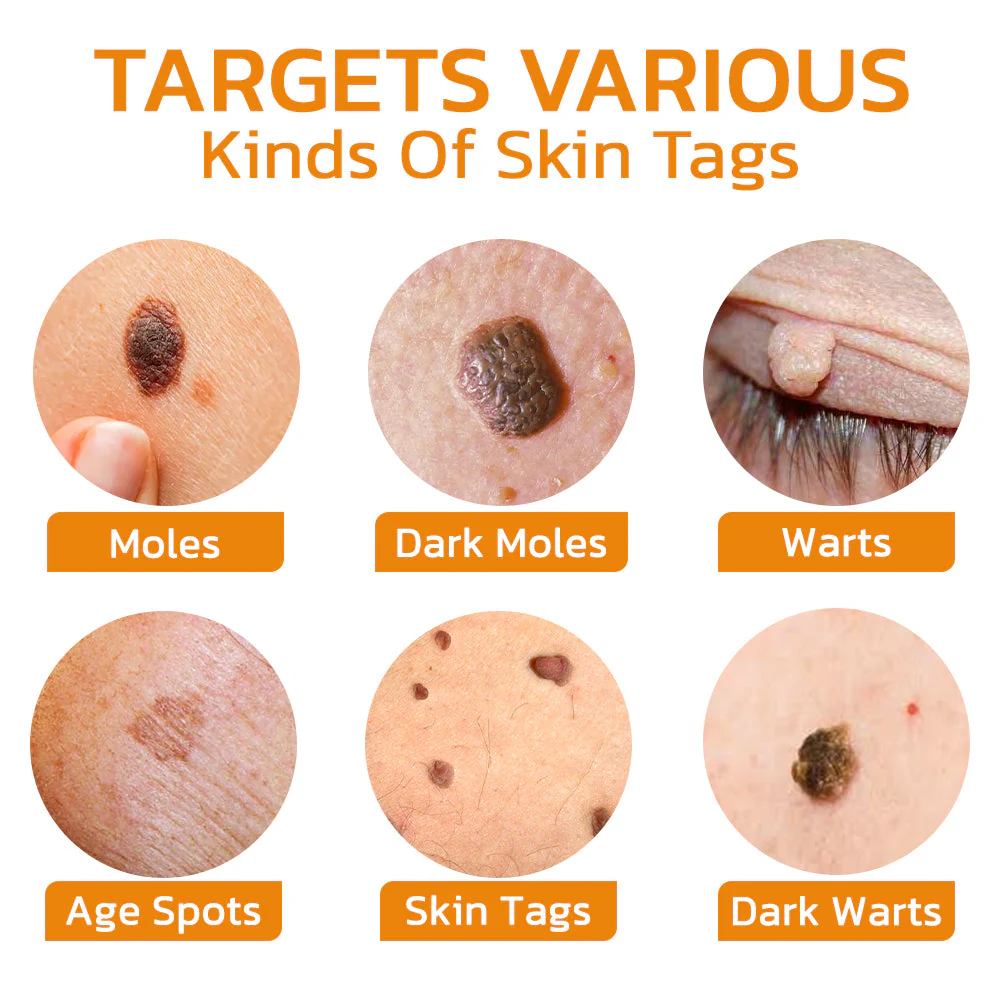 TagGone™ Bee Venom Treatment Gel - Image 6