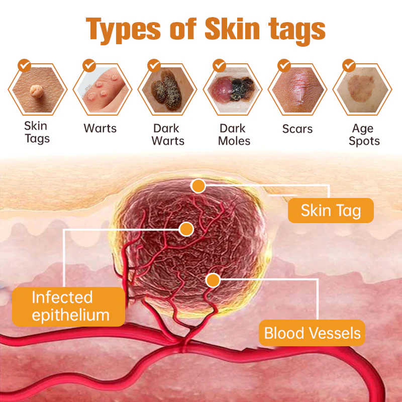 ๐
๐๐๐๐๐โข ๐ฉ๐๐ ๐ฝ๐๐๐๐ ๐พ๐๐๐ ๐๐ซ๐๐๐ญ๐ฆ๐๐ง๐ญ ๐ช๐๐๐๐ - Image 4