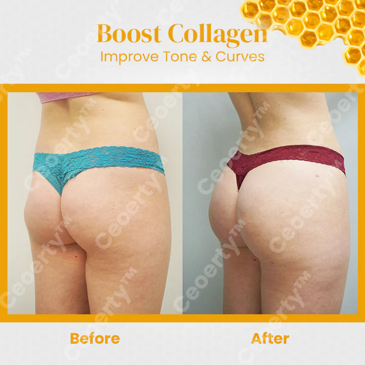 Ceoerty™ BootyBeaute Bee Venom Body Cream - Image 7