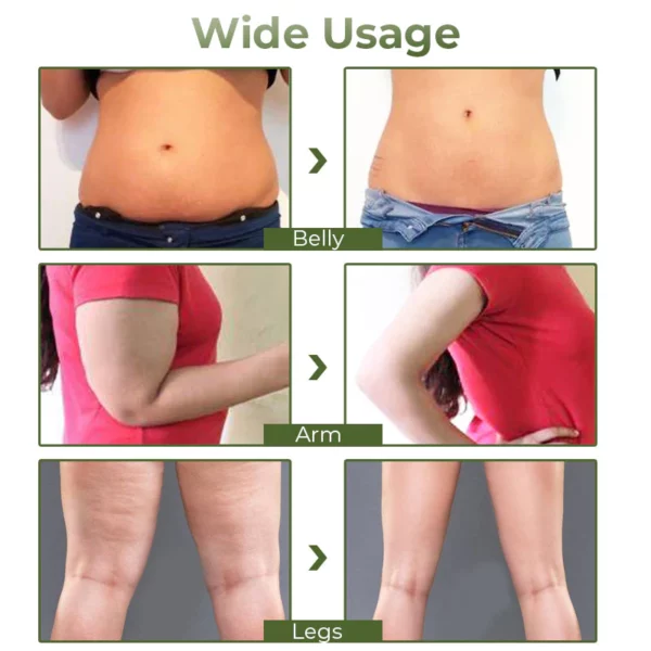 GFOUK™ Slimming and Fat Burning Cream - Image 3