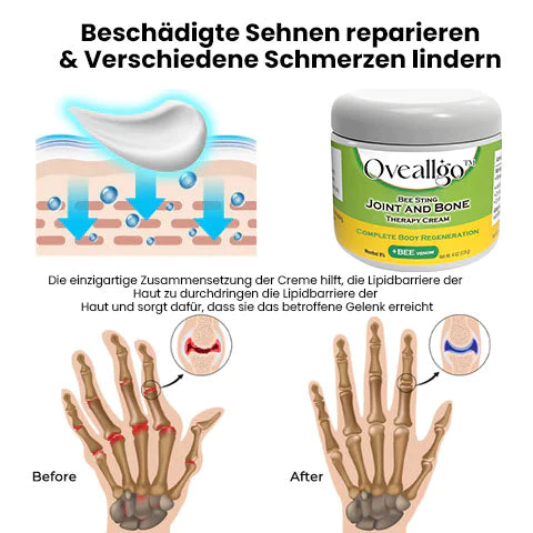 Oveallgo™ Bee Sting Gelenk PURI - und Knochentherapiecreme – vollständige Körperregeneration - Image 3