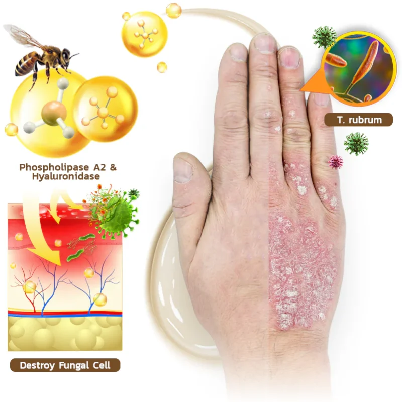 GFOUK™ PsoriX Bee Venom Cream - Image 6