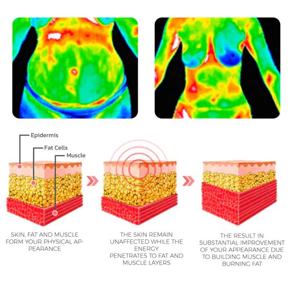 ATTDX ProSlimming AppleCider Jelly - Image 9