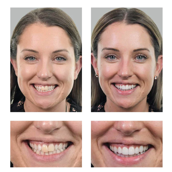 COLL-Boost™ Conopeptide Anti-Aging Essence (Botox) - Image 4