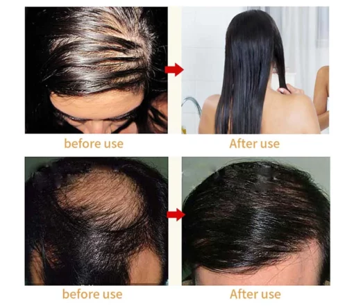 ANGUL™ Laser Scalp Massager Comb - Image 6