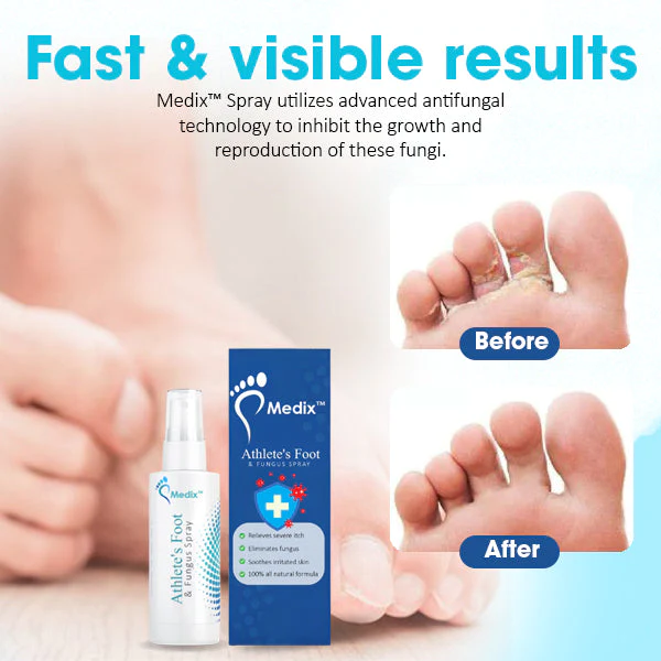 Medix™ Athlete’s Foot & Fungus Spray - Image 2