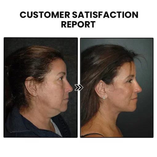 EarFit™ Acupressure Slimming Earrings - Image 5