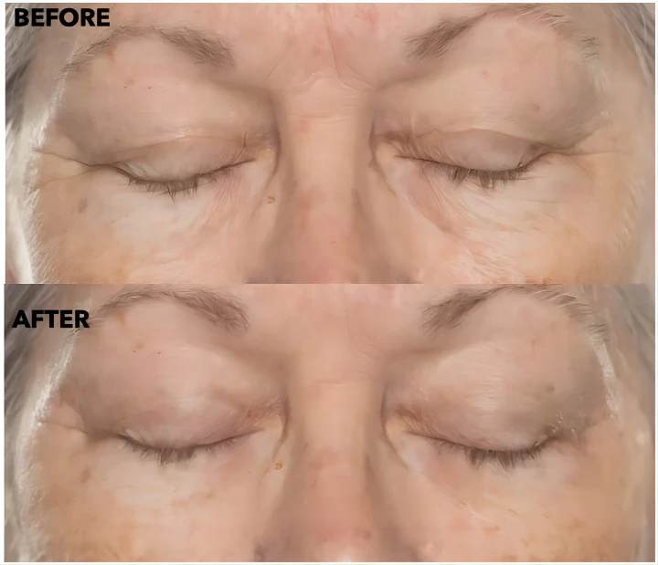 SkinRevive™ Facial Botox Serum - Image 7