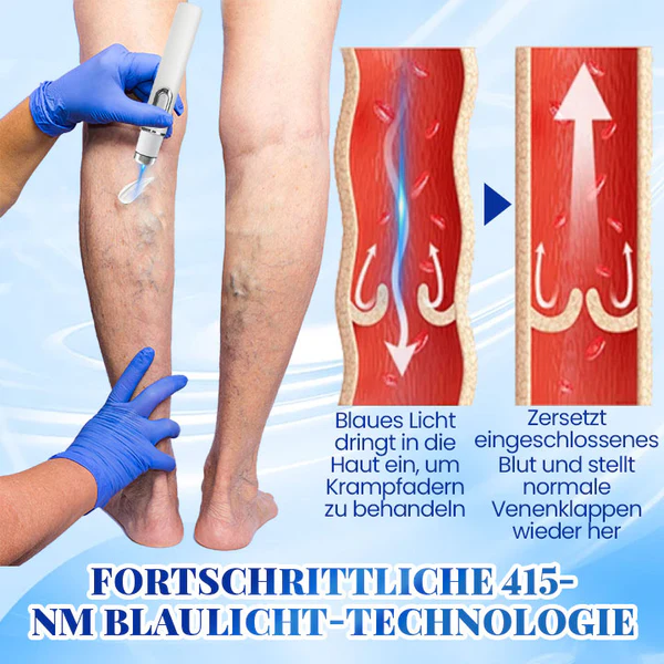 Biancat™ Blaulicht-Therapie-Set für Krampfadern - Image 3