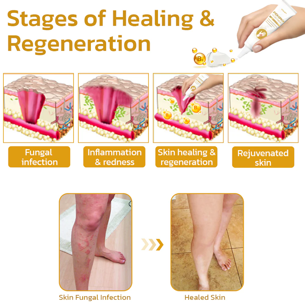 GFOUK™ PomphX Relief Cream - Image 5