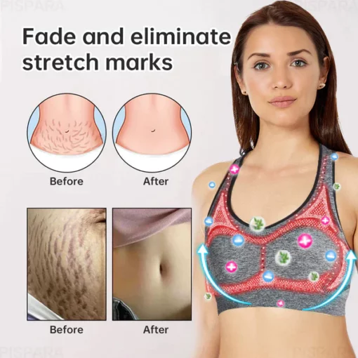 RUELENS™ Ion Lifting & Lymphvity Entgiftungs-BH - Image 2