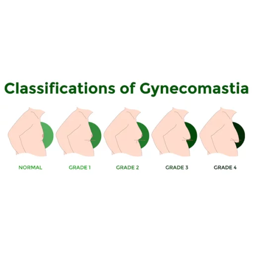 flysmus™ SoliPac Gynecomastia Tightening Herbal Cream - Image 5