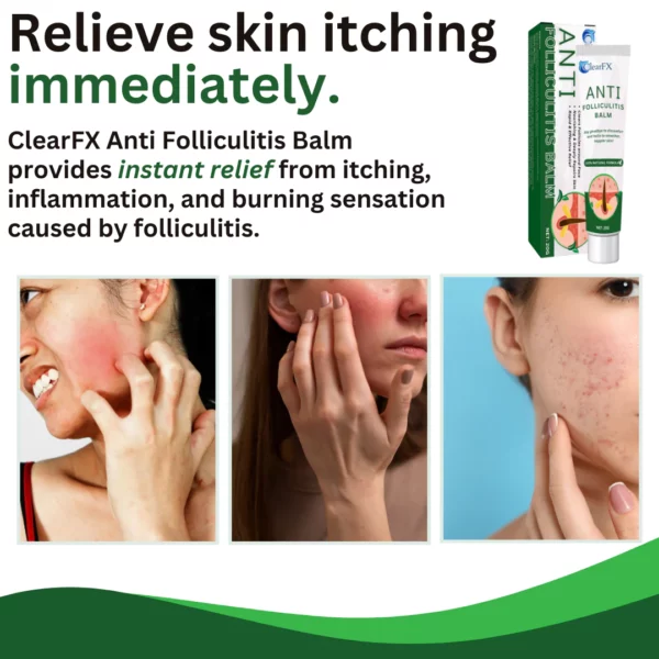 Cuzvc™ Anti-Folliculitis Balm - Image 7