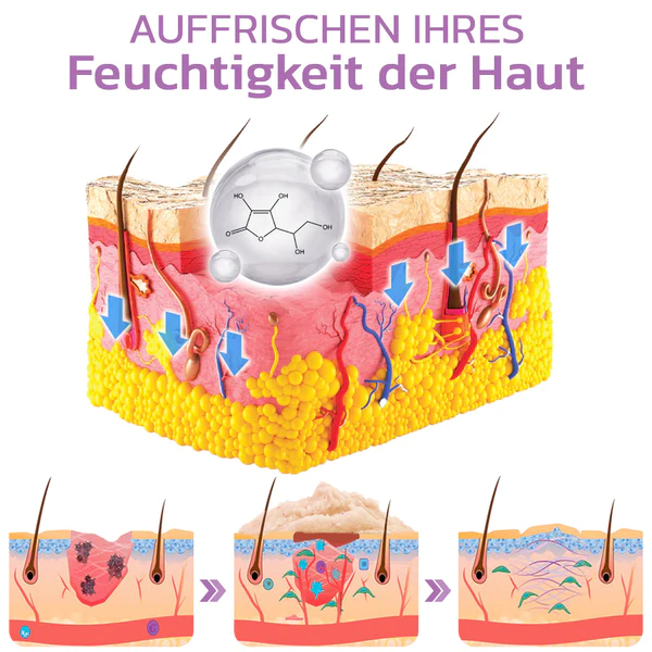 flysmus™ KP Keratose Gleichgewicht Radiergummi Körper Peeling - Image 6