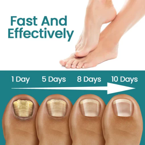 Ceoerty™ Nail Repair Patch - Image 5