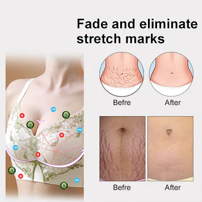 PISPARA™s Lymphatic Drainage & Shaping Powerful Lift Lace Bra - Image 8