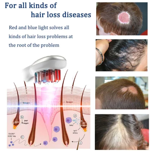 ANGUL™ Laser Scalp Massager Comb - Image 4