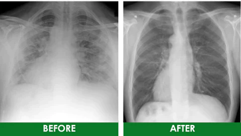 Respira™ Lung Care Spray - Image 6