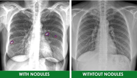 Respira™ Lung Care Spray - Image 5