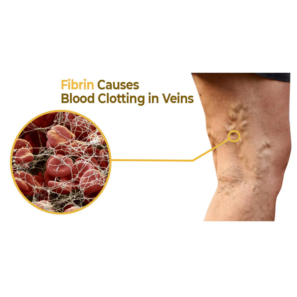 flysmus™ Varico-X Vein Dredge Bee Venom Spray - Image 9