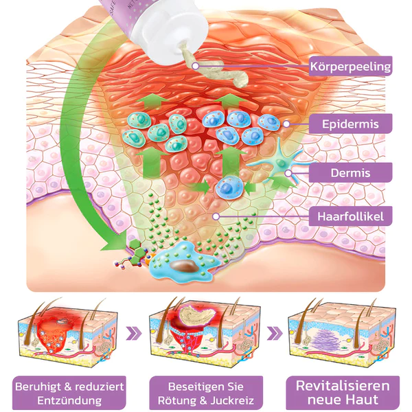 flysmus™ KP Keratose Gleichgewicht Radiergummi Körper Peeling - Image 5