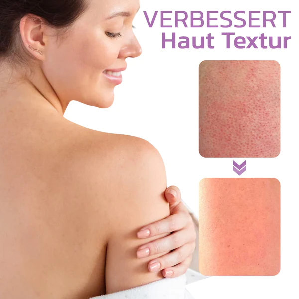 flysmus™ KP Keratose Gleichgewicht Radiergummi Körper Peeling - Image 4