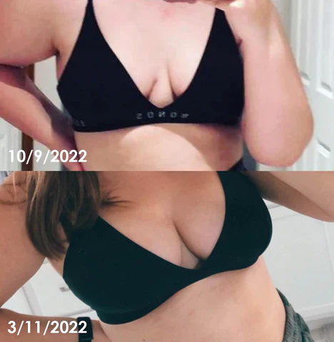 Ricpind EMSLift PlumpUp BustMassager - Image 4