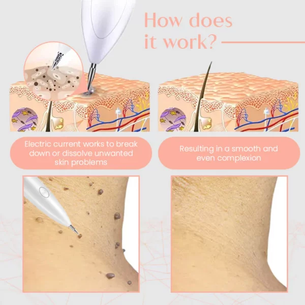 Ceoerty™ SpotX NanoPRO Electric Cosmetic Pen - Image 3