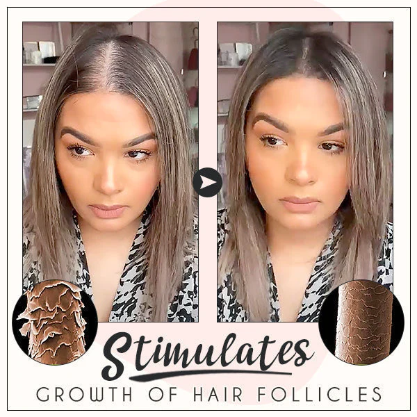 EELHOE™ Hair Boost Ginger Cream - Image 5