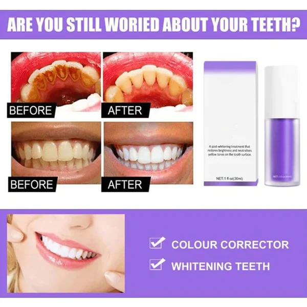 Smilekit™ Deluxe Herbal Teeth Whitening Mousse - Image 4
