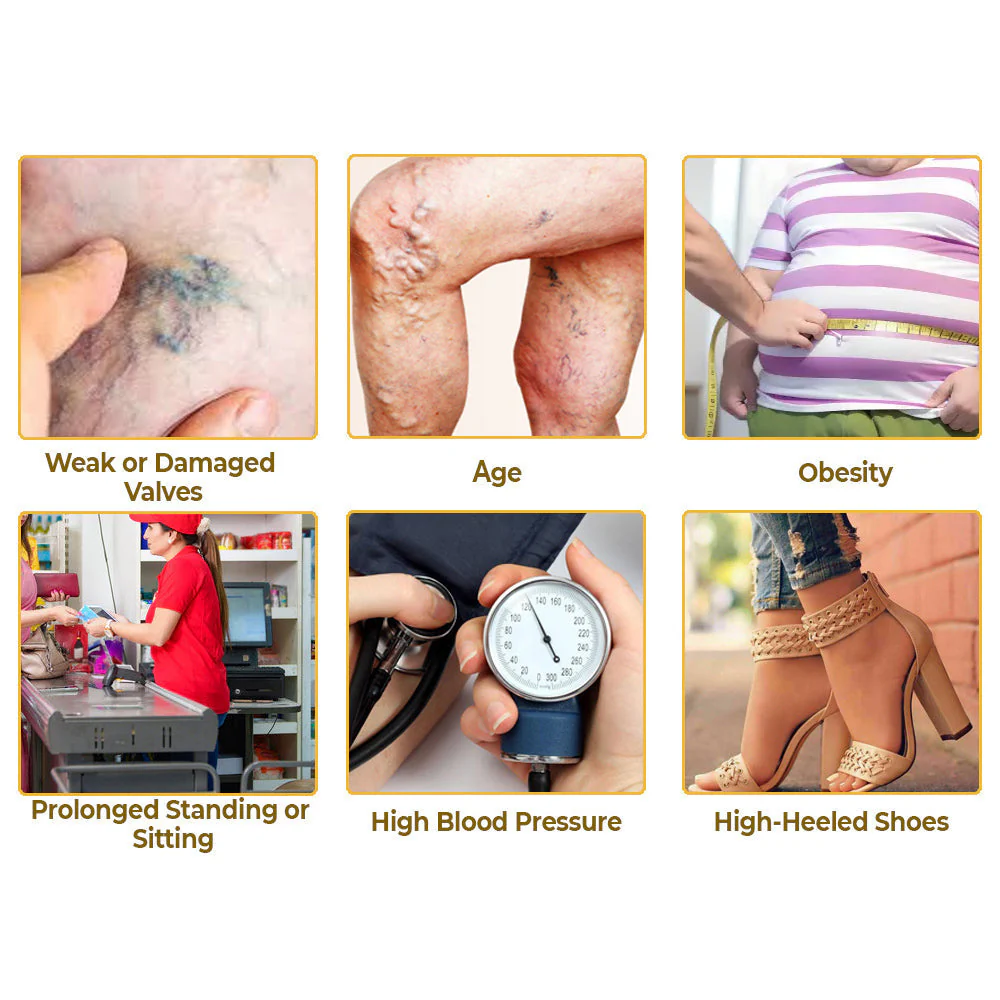 flysmus™ Varico-X Vein Dredge Bee Venom Spray - Image 8