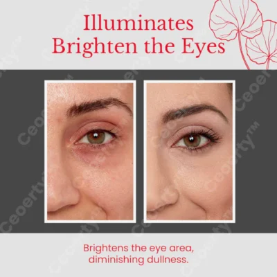 Ceoerty™ Luminance Eye Rejuvenating Cream - Image 6