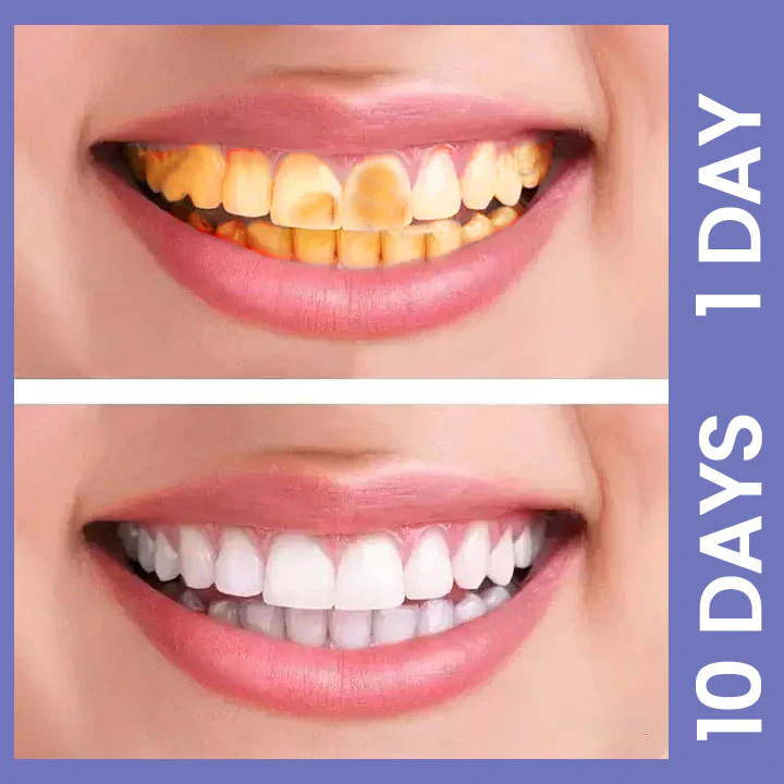 Ceoerty™ StainXpert Tooth Repair Ampoule - Image 3