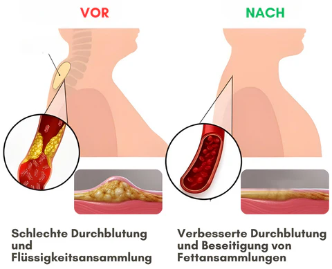 NutRelief™ Bienengift Witwe Behandlungscreme - Image 7