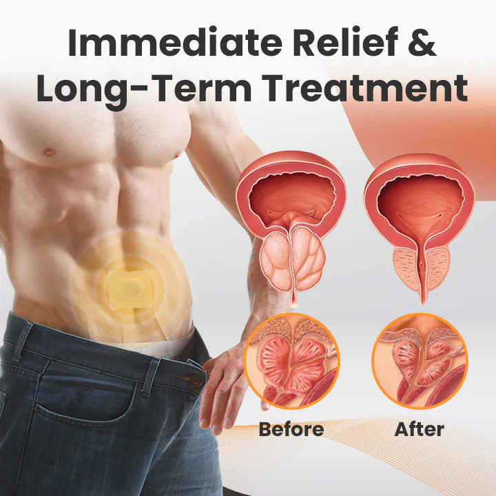 Unpree™ Natural Prostate Comfort Patch for Men - Image 4