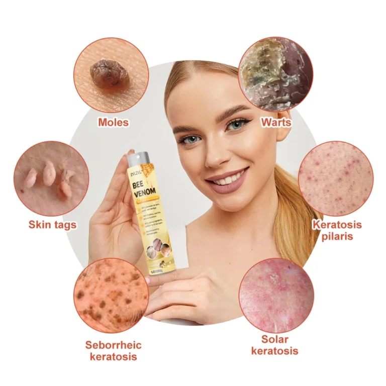 ZVLZVL™ Bee Venom Mole and Wart Treatment Spray - Image 10