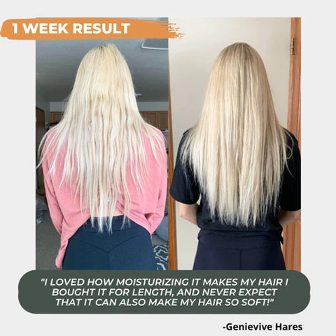 Nutri™ Hair Growth Nourishing Spray - Image 5