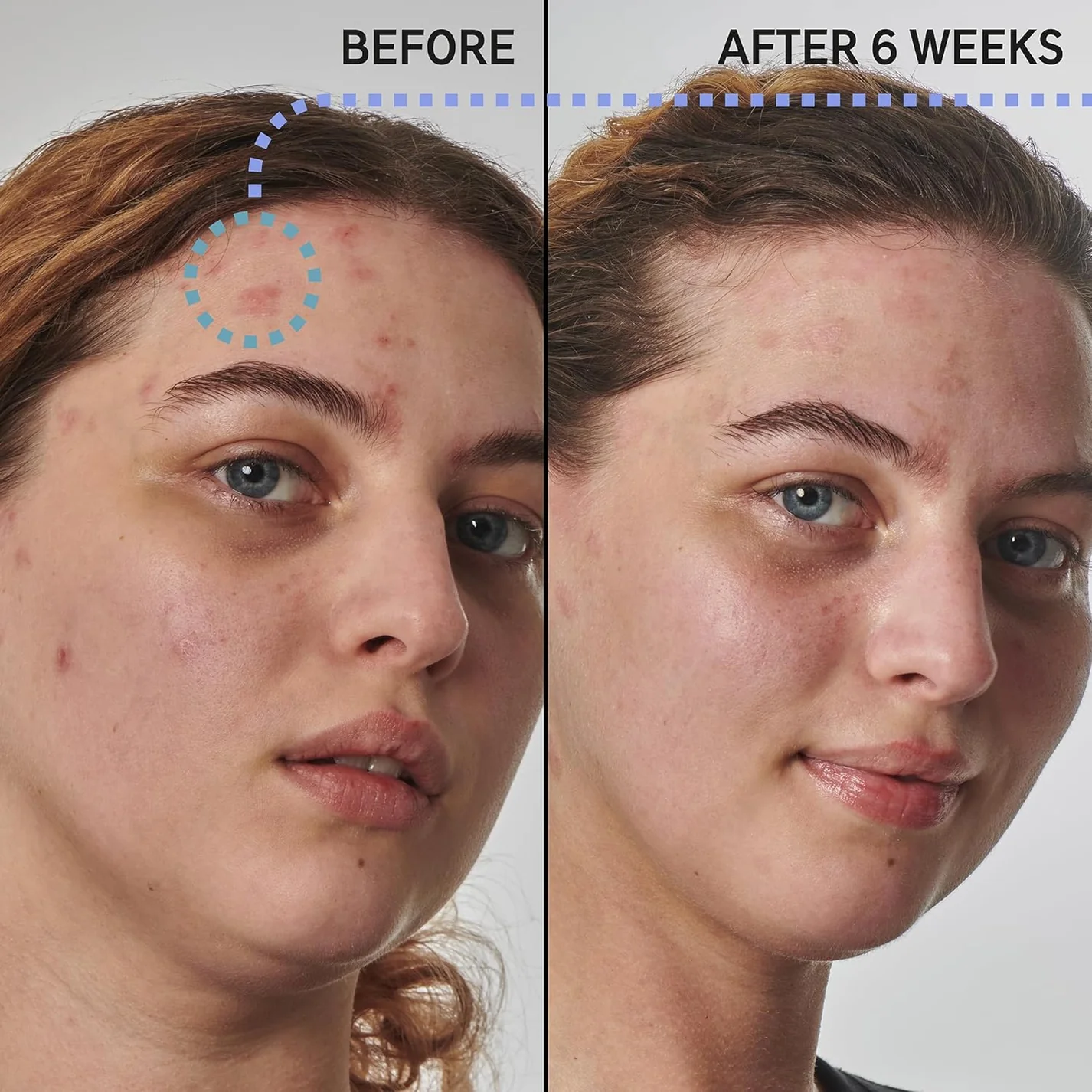 Peptide Moisturizer - Image 3