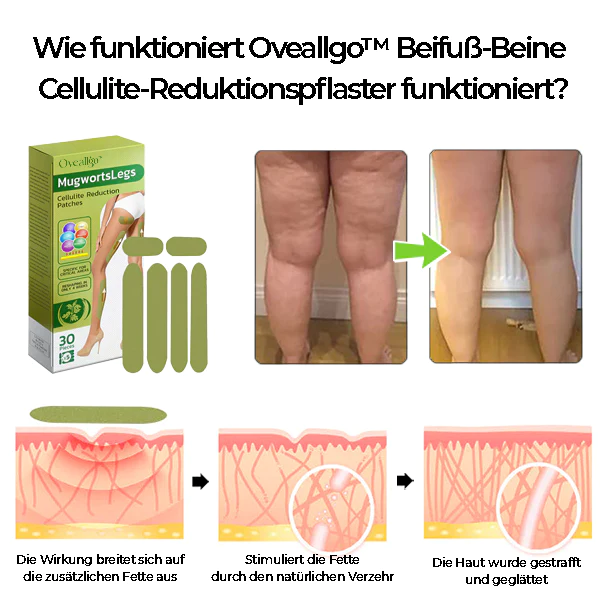 Oveallgo™ Beifuß-Beinpflaster zur Reduzierung von Cellulite - Image 4