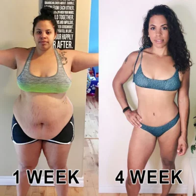 Cvreoz™ Bee Venom Detoxification Patch - Image 4