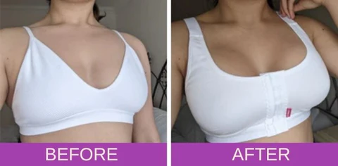 Cuvena™ Breast Enhancement Capsule Suppository - Image 4