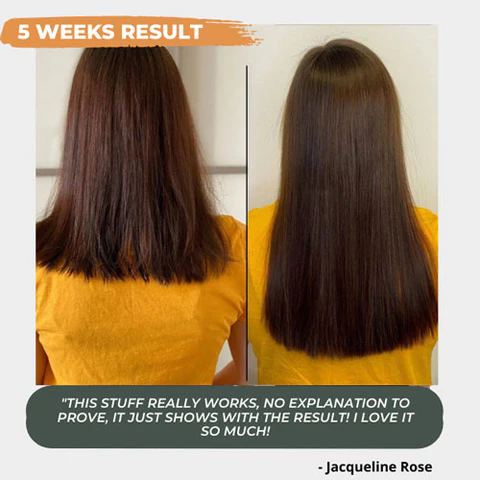 Nutri™ Hair Growth Nourishing Spray - Image 4