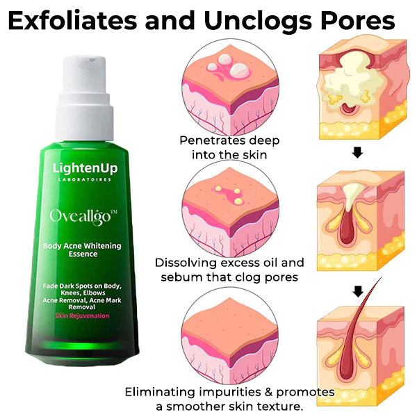 Oveallgo™ Körper Aufhellen Akne-Serum (zur Entfernung von Akne, Pickeln und Acanthosis nigricans) - Image 4