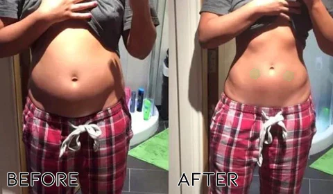 Oveallgo™ TruLax Constipation Patch - Image 9