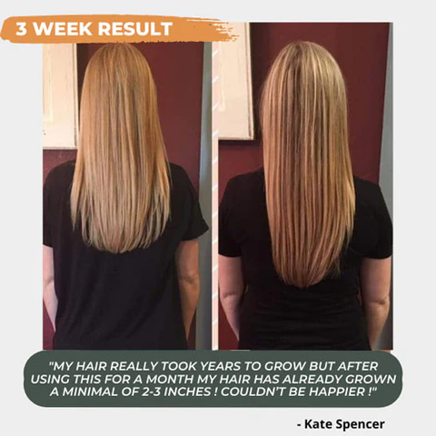 Nutri™ Hair Growth Nourishing Spray - Image 3